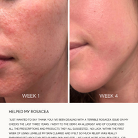 Glass Skin Liquid Exfoliant