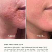 Glass Skin Liquid Exfoliant