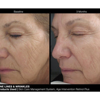 Age Intervention Retinol Plus