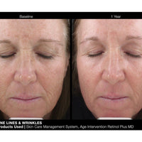 Age Intervention Retinol Plus MD