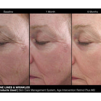 Age Intervention Retinol Plus MD