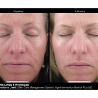 Age Intervention Retinol Plus MD