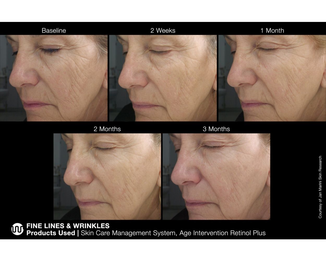 Age Intervention Retinol Plus – Artisan of Skin LA