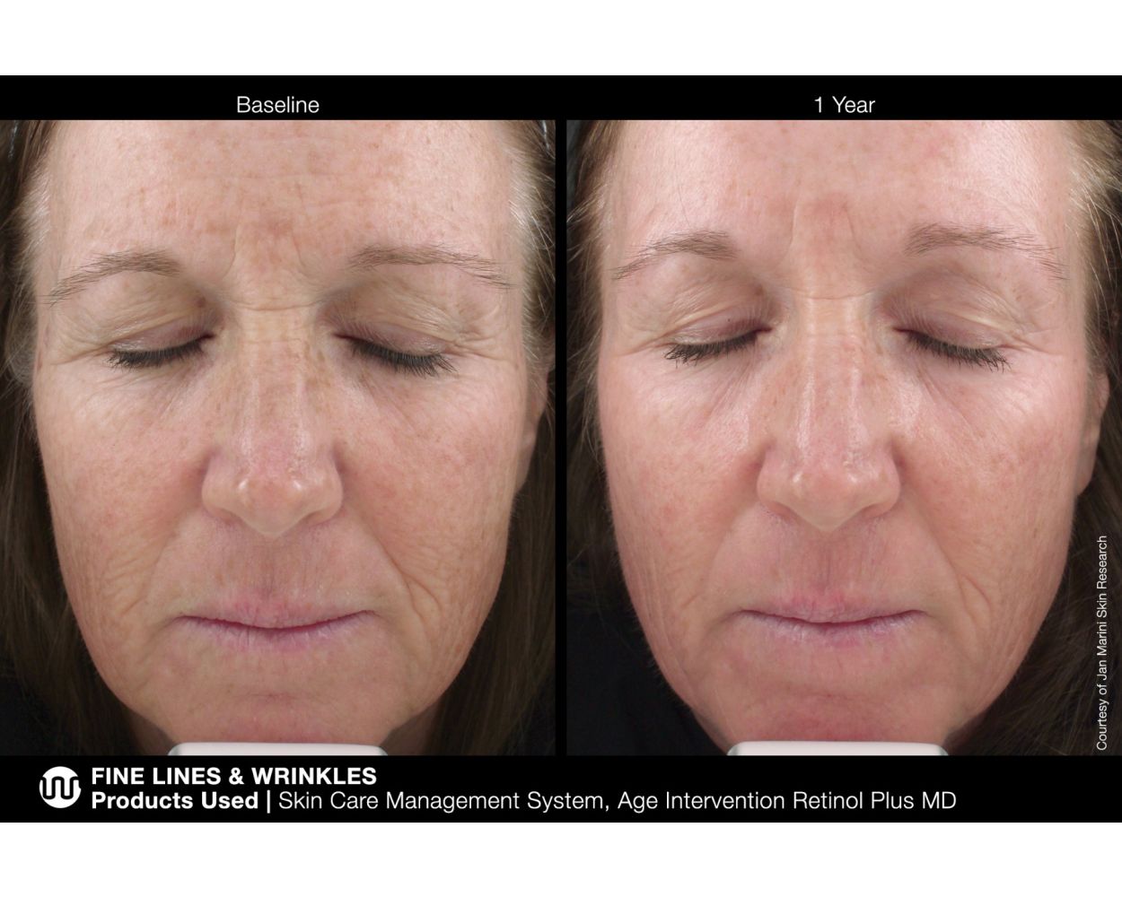 Age Intervention Retinol Plus MD – Artisan of Skin LA