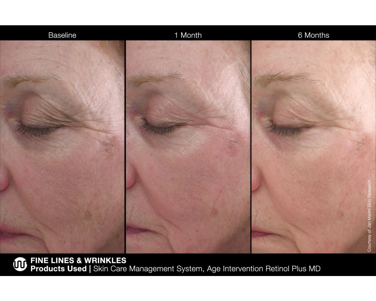 Age Intervention Retinol Plus MD – Artisan of Skin LA