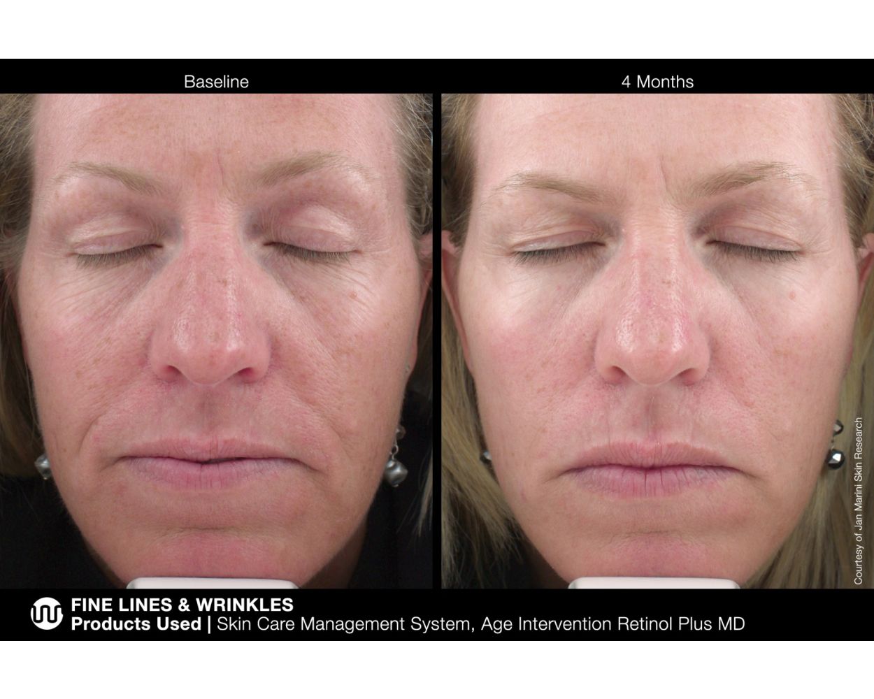 retinolplusmd_3_hd_4100x.jpg?v
